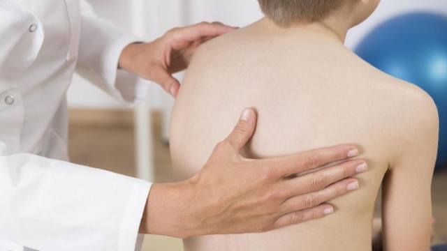 Hati-Hati Bahu Tinggi Sebelah, Bisa Saja Itu Skoliosis