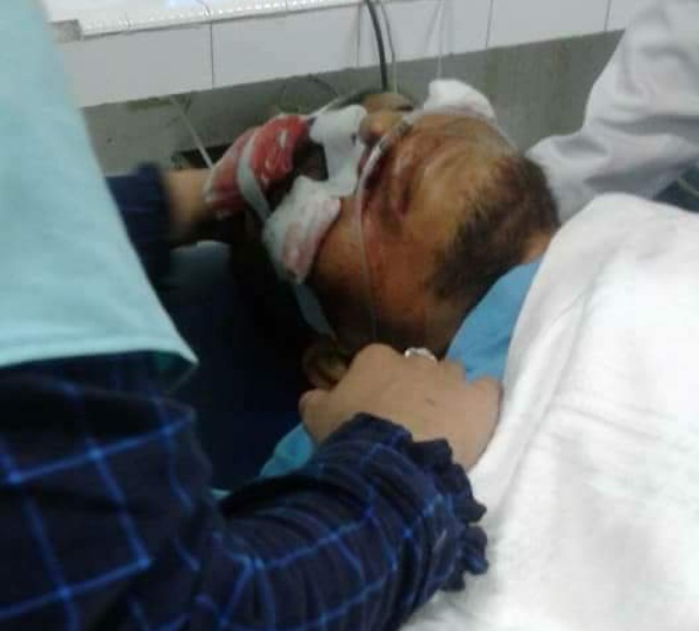 Diseruduk Truk, Honorer Pemkab Siak Meninggal Dunia