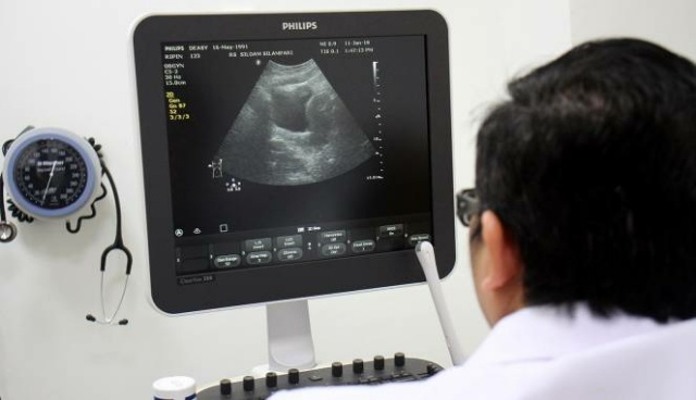 Skrining Saja Tak Bisa Turunkan Insiden Kanker Serviks