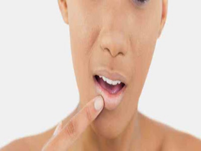 Penyebab dan Solusi Atasi Bibir Hitam Secara Alami