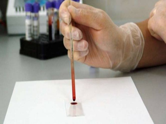 Cara Mencegah Thalasemia