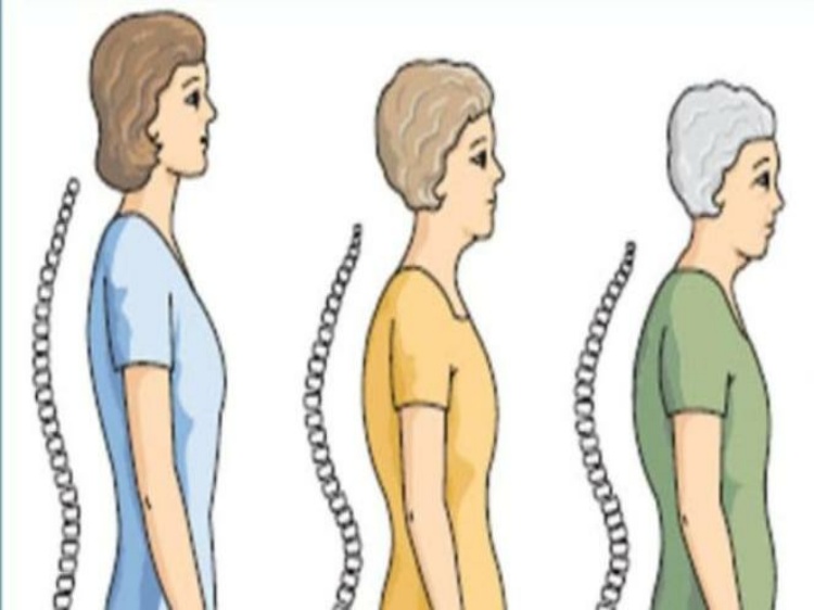 Penuaan Tak Melulu Kulit Keriput, Coba Cek Organ Dalam