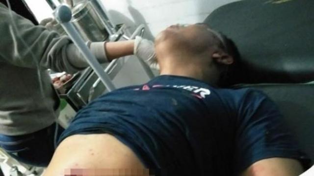 Berkelahi, Wakil Rakyat Ini Dibacok di Lapo Tuak