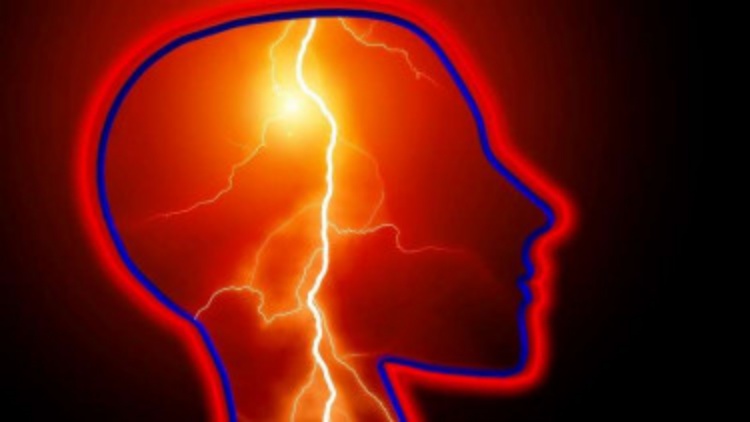 Waspada, Stroke Menyerang Anak Muda