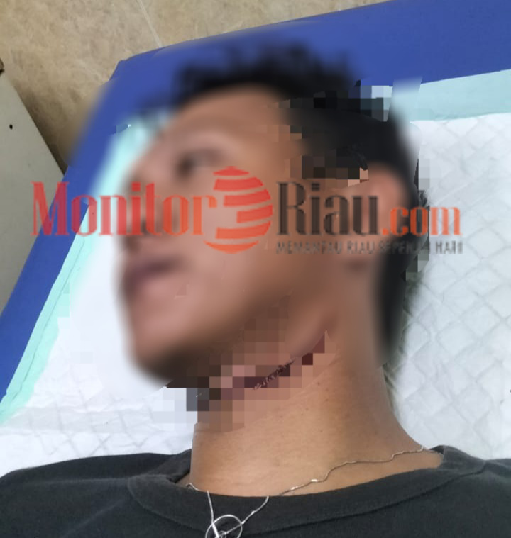 Akibat Kabel Internet Terjuntai, Leher Seorang Warga Jalan Jawa Duri Nyaris Putus
