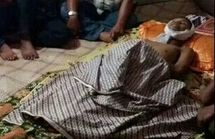 Akibat Telan Miras Beralkohol Tinggi, Pelajar Ini Meregang Nyawa