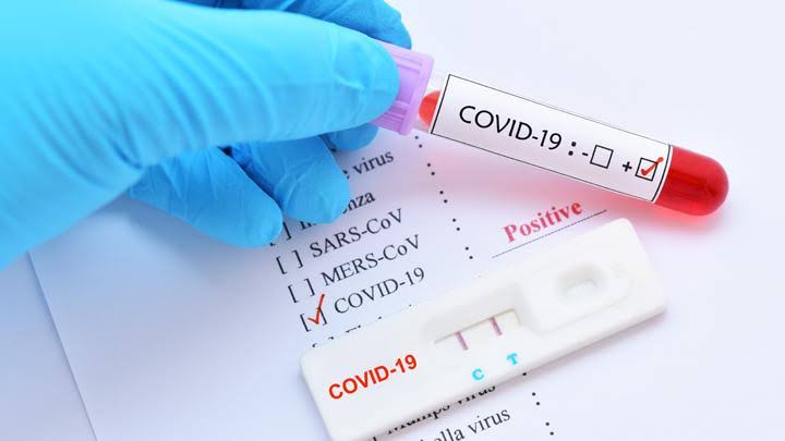 Hasil Rapid Test, Satu PDP di Dumai Positif