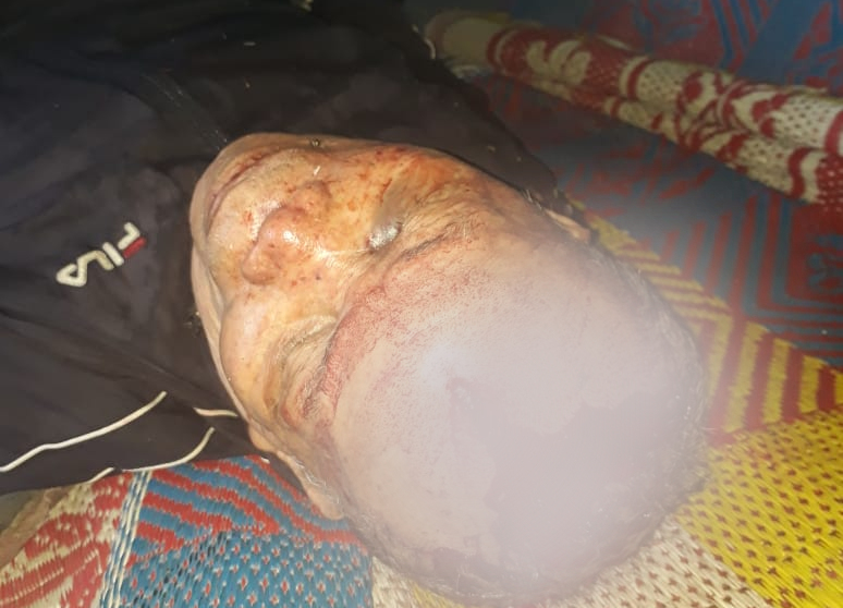 Labuhanbatu Mencekam, Pencuri Walet Bacok Korban hingga Krisis