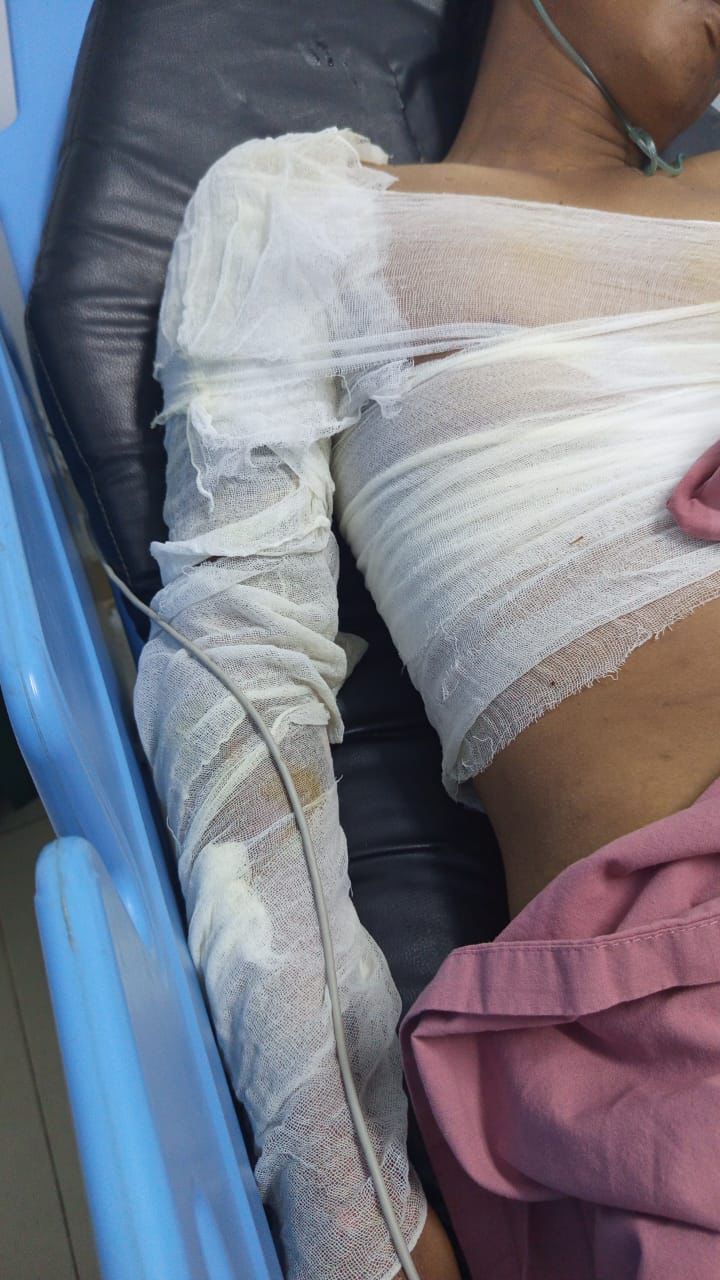 Pasang Kabel Internet, Separuh Tubuh Fathier Hangus Disetrum Listrik, DPRD Pekanbaru Desak My Republic Bertanggung Jawab