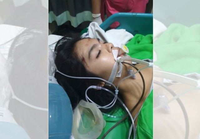 Wanita Muda Koma Terjatuh Dari Motor Setelah Di Jambret