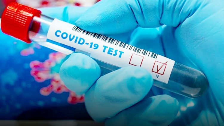 Hasil Rapid Test, Empat Warga Dumai dan Satu Crew Kapal Didapati Memiliki Reaktif Virus Corona