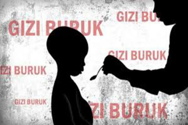 Akibat Kurang Gizi, Balita Asal Langgam Dirawat di RSUD Selasih