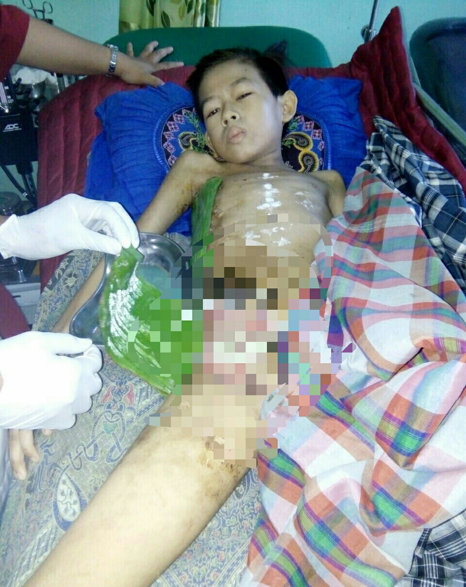 Putra Seorang Buruh Ini Derita Penyakit Tumor di Bagian Perut