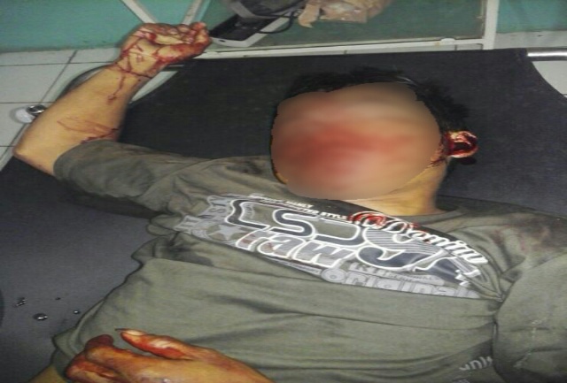 Tabrak Fuso, Suherman Langsung Ini Tewas di Lokasi