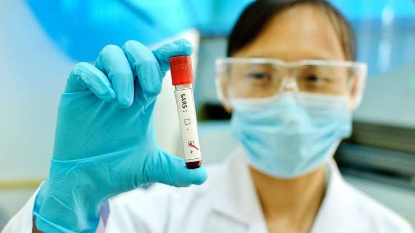 Pasien Positif Corona di Riau Bertambah Jadi 2 Orang
