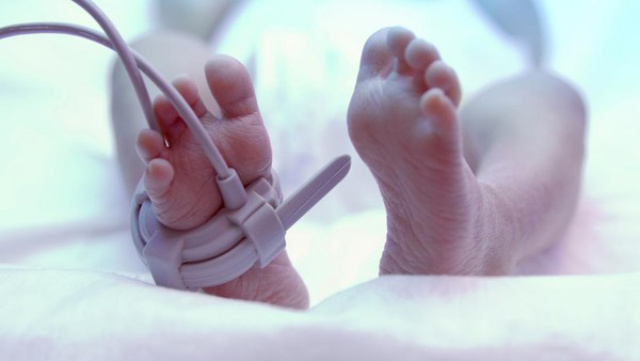 Bayi Putus Kepala di Inhil Riau Disebut Sudah Meninggal dalam Kandungan