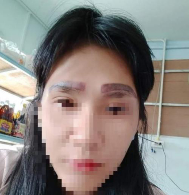 Bikin Tato Alis di Klinik Murah, Wanita Ini Jadi Punya 4 Alis Sekaligus