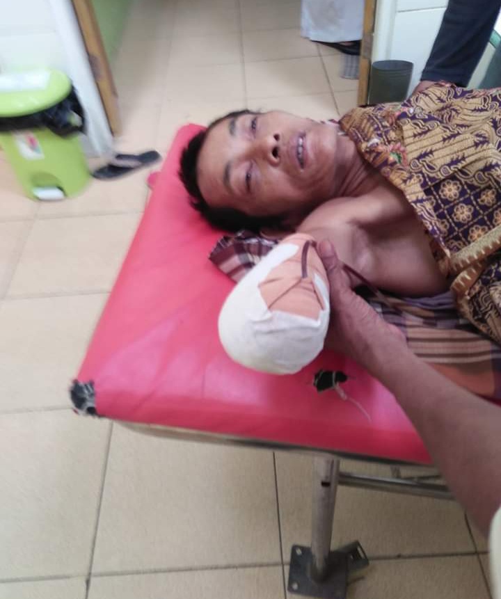 Eggrek Jatuh Saat Panen Karyawan PT Serikat Putra Putus Tangan