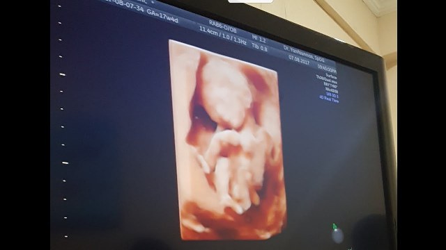 Penemuan Janin Bayi dalam Jok Motor di Riau, Ini Tersangkanya
