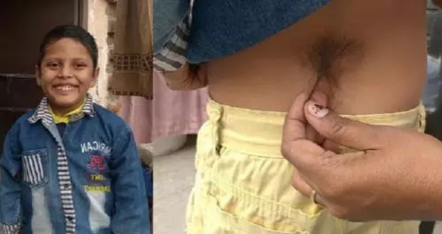 Viral Bocah 6 Tahun Punya Ekor, Disembah bak Dewa Hanuman!