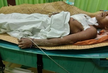 Petani di Inhu Nyaris Tewas Diterkam Buaya