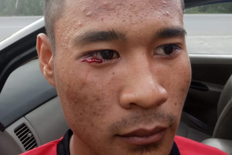 Polresta Pekanbaru Usut Oknum Wasit Aniaya Pesepakbola U-17