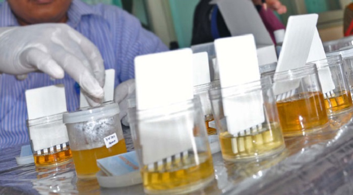 Walah...!!! Pinta Untuk Lakukan Tes Urine, BNN Riau Sebut Tak Punya Anggaran